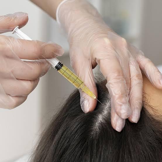 Hair Loss Treatment