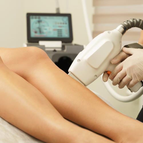 laser hair removal legs