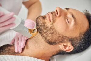 beard reshaping with laser