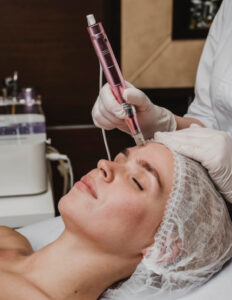 Microneedling dermapen 4 facial
