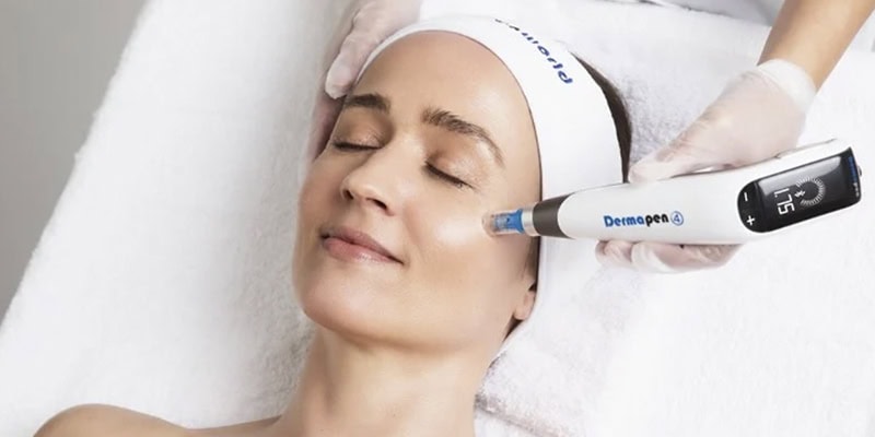 Microneedling dermapen 4