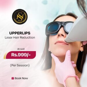 Laser Hair Removal chin upper lip