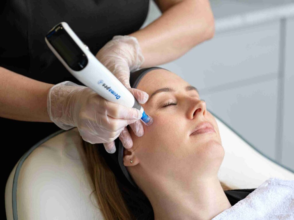 Dermapen-4 microneedling