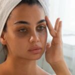 undereye hollowness