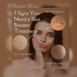 Skinboosters profhilo treatment