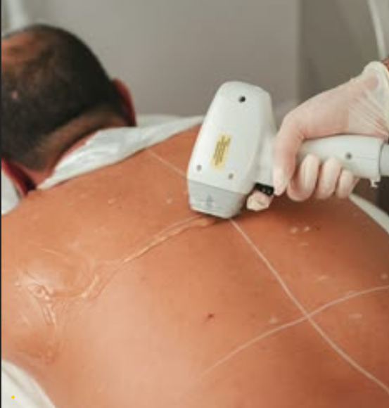 Laser hair removal back and front male